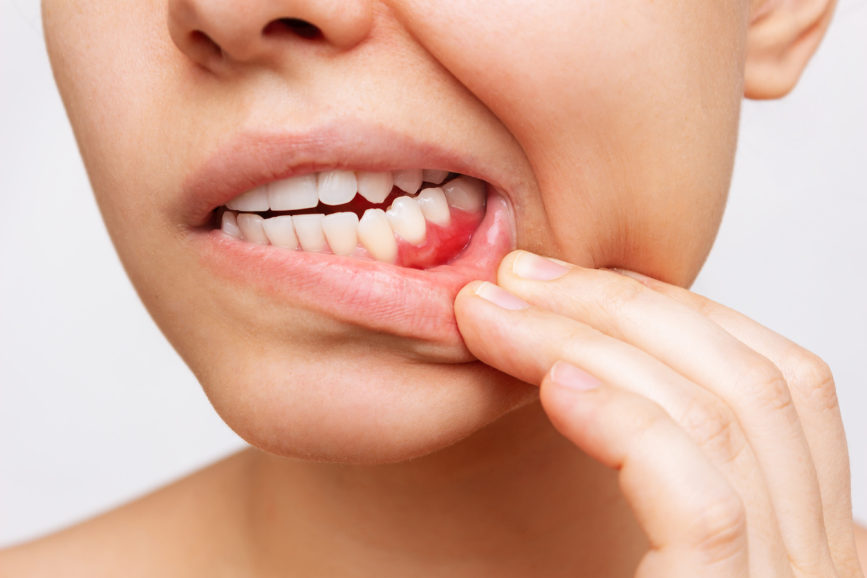 how long until a tooth infection kills you