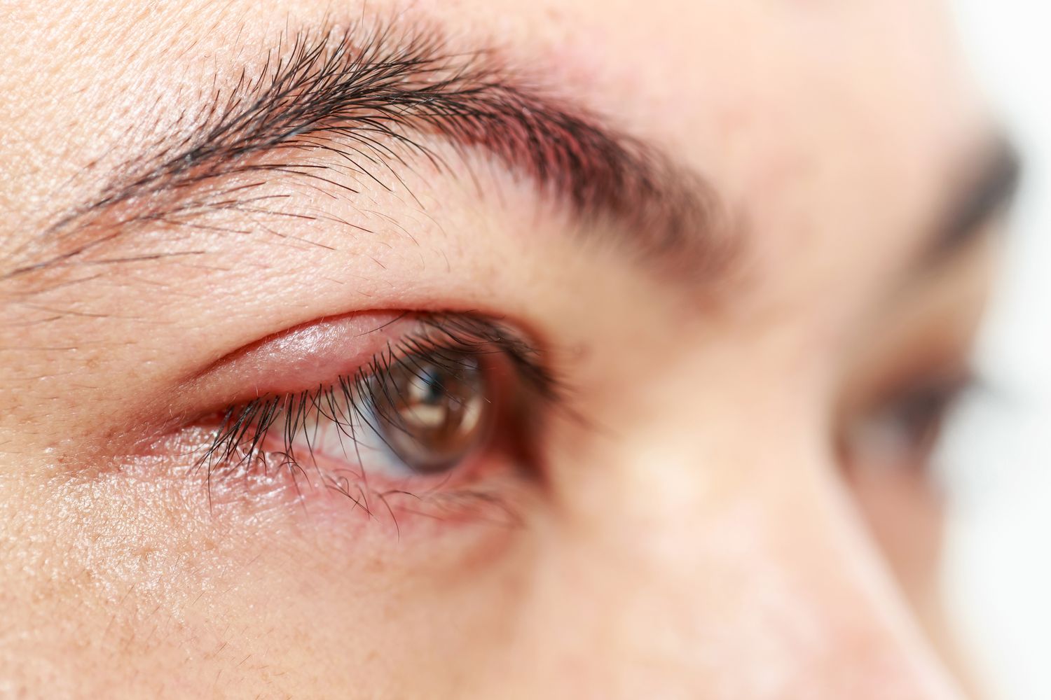 how do you get rid of a stye in 5 minutes