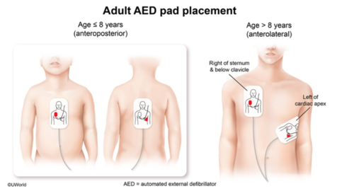 Anteroposterior