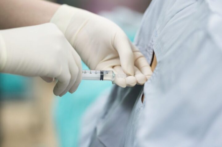 epidural steroid injection